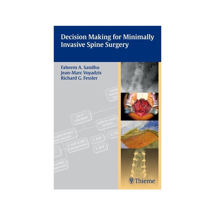Decision Making for Minimally Invasive Spine Surgery  Sandhu Faheem A.; Voyadzis Jean-Marc; Fessler Richard Glenn  Thieme Medical Publishers  9781604062663