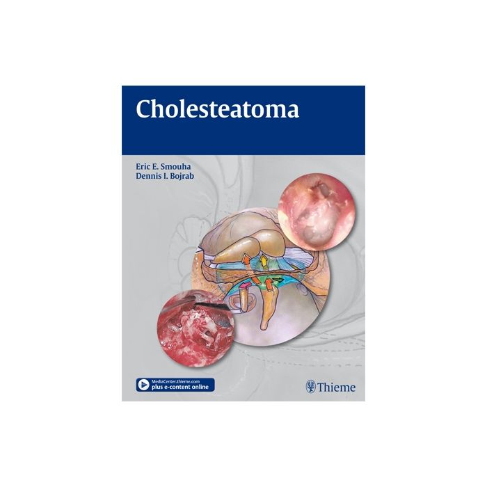 Cholesteatoma   Smouha Eric E.; Bojrab Dennis I.  Thieme Medical Publishers  9781604062779