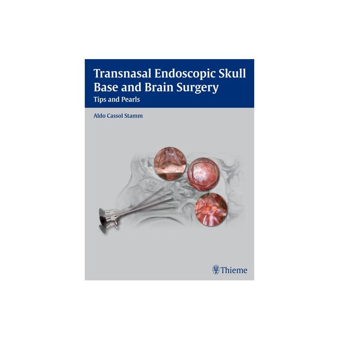 Transnasal Endoscopic Skull Base and Brain Surgery. Tips and Pearls  Stamm Aldo C.  Thieme Medical Publishers  9781604063103
