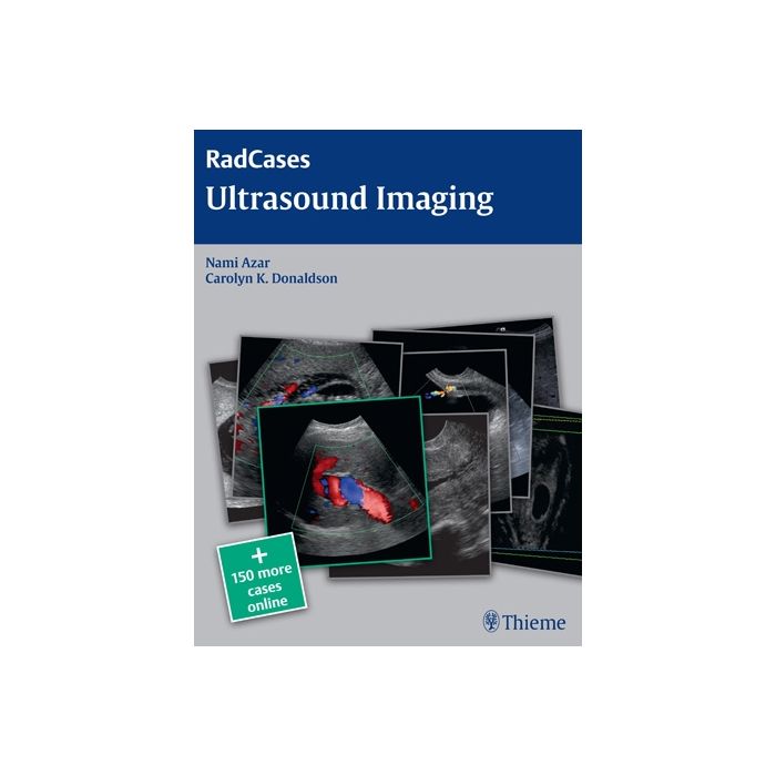 Ultrasound Imaging Azar Nami R.; Donaldson Carolyn Thieme Medical Publishers 9781604063226 Ultrasound Imaging Azar Nami R.; Donaldson Carolyn Thieme Medical Publishers 9781604063226