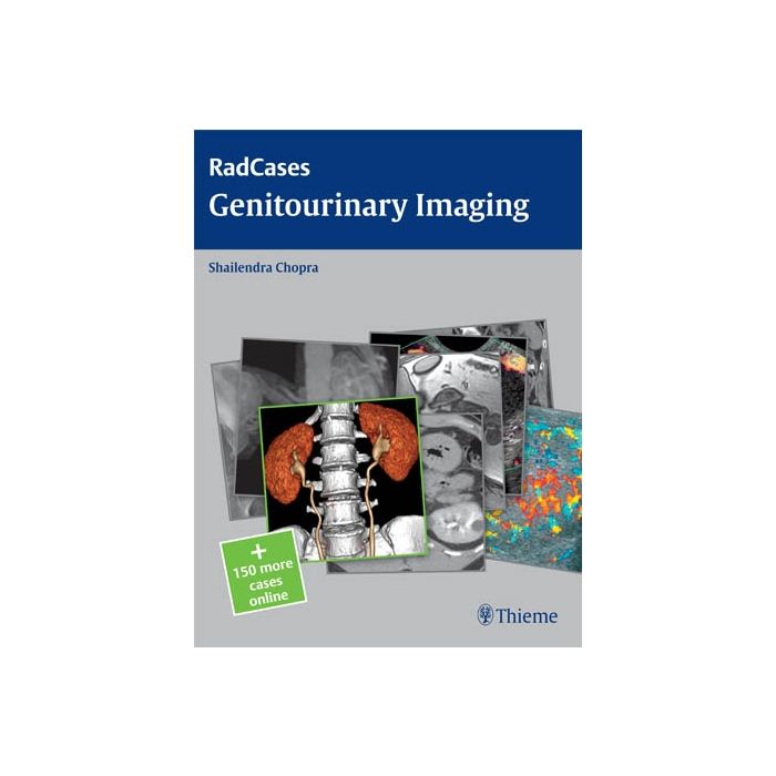 Genitourinary Imaging Chopra Shailendra Thieme Medical Publishers 9781604063240 Genitourinary Imaging Chopra Shailendra Thieme Medical Publishers 9781604063240
