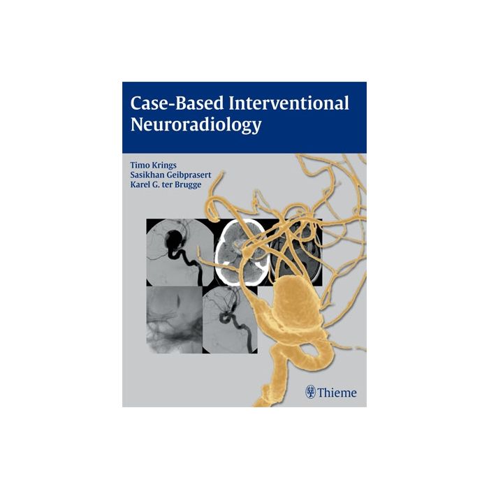 Case-Based Interventional Neuroradiology  Krings Timo; Geibprasert Saskhan; Ter Brugge Karel  Thieme Medical Publishers  9781604063738