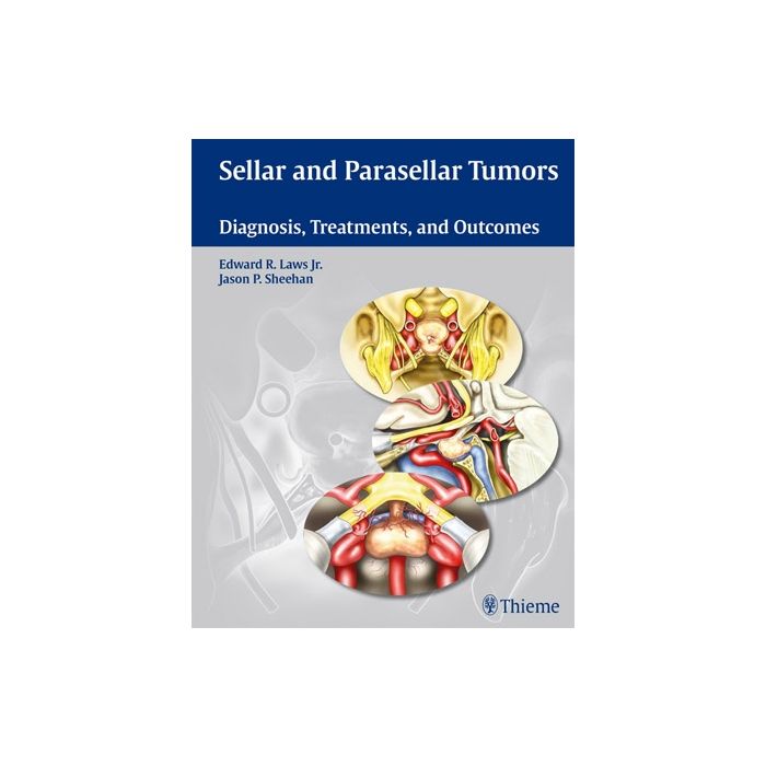 Sellar and Parasellar Tumors. Diagnosis, Treatments, and Outcomes  Laws Edward R.; Sheehan Jason P.  Thieme Medical Publishers  9781604064216