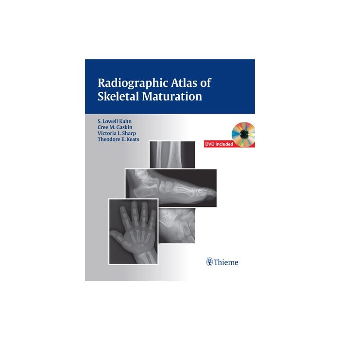 Radiographic Atlas of Skeletal Maturation  Kahn S. Lowell; Gaskin Christopher M.; Sharp Victoria L.; Keats Theodore E.; Li Bing  Thieme Medical Publishers  9781604065718