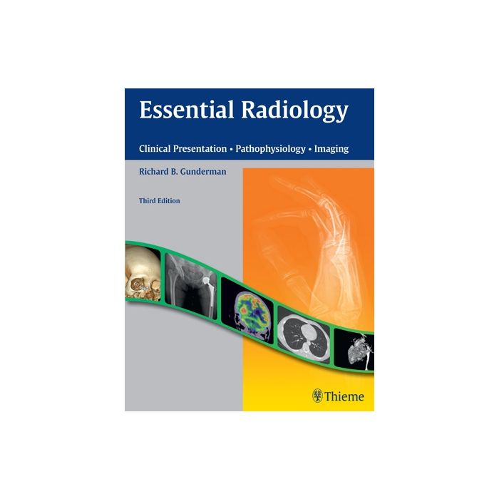 Essential Radiology. Clinical Presentation - Pathophysiology - Imaging Gunderman Richard B. Thieme Medical Publishers 9781604065732 Essential Radiology. Clinical Presentation - Pathophysiology - Imaging Gunderman Richard B. Thieme Medical Publishers 9781604065732