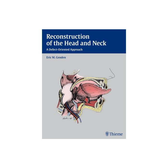 Reconstruction of the Head and Neck. A Defect-Oriented Approach  Genden Eric M.  Thieme Medical Publishers  9781604065763