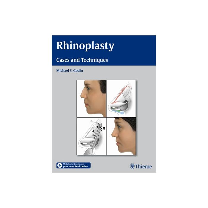 Rhinoplasty. Cases and Techniques Cases and Techniques  Godin Michael S.  Thieme Medical Publishers  9781604066807 Rhinoplasty. Cases and Techniques Cases and Techniques  Godin Michael S.  Thieme Medical Publishers  9781604066807