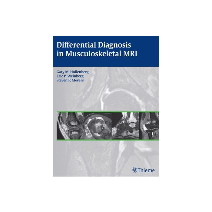 Differential Diagnosis in Musculoskeletal MRI  Hollenberg Gary M.; Weinberg Eric P.; Meyers Steven P.  Thieme Medical Publishers  9781604066838 Differential Diagnosis in Musculoskeletal MRI  Hollenberg Gary M.; Weinberg Eric P.; Meyers Steven P.  Thieme Medical Publishers  9781604066838