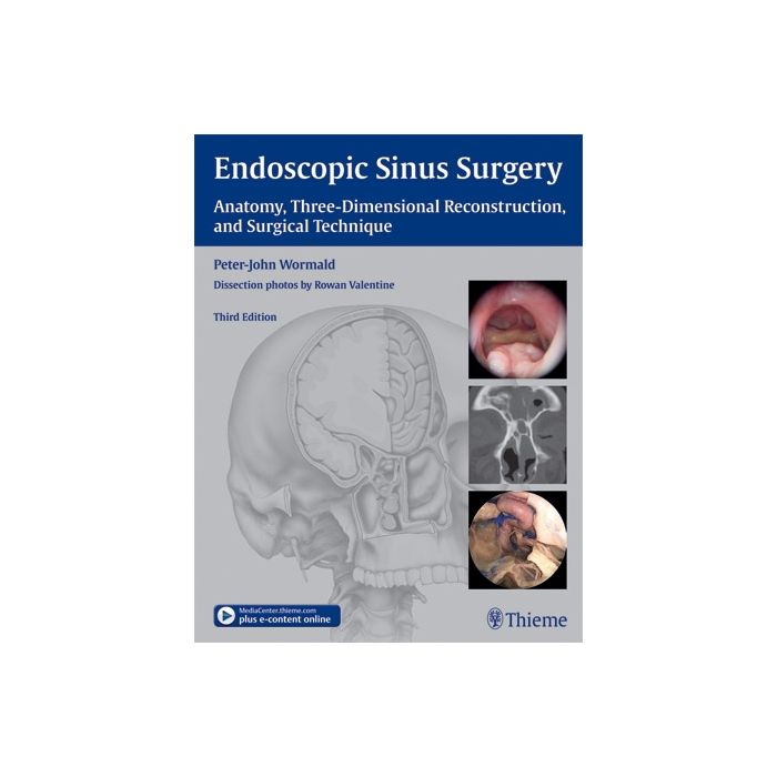 Endoscopic Sinus Surgery. Anatomy, Three-Dimensional Reconstruction, and Surgical Technique  Wormald Peter-John  Thieme Medical Publishers  9781604066876