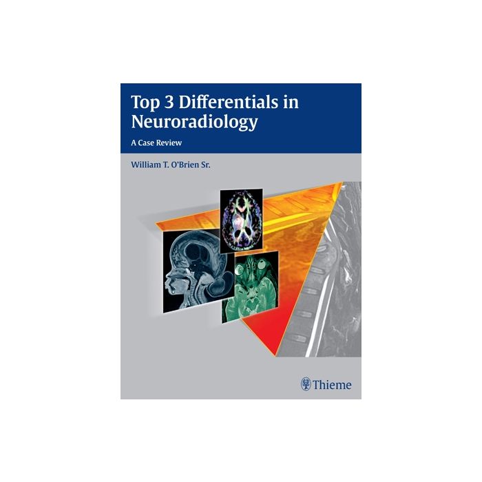 Top 3 Differentials in Neuroradiology  O'Brien William T.  Thieme Medical Publishers  9781604067231