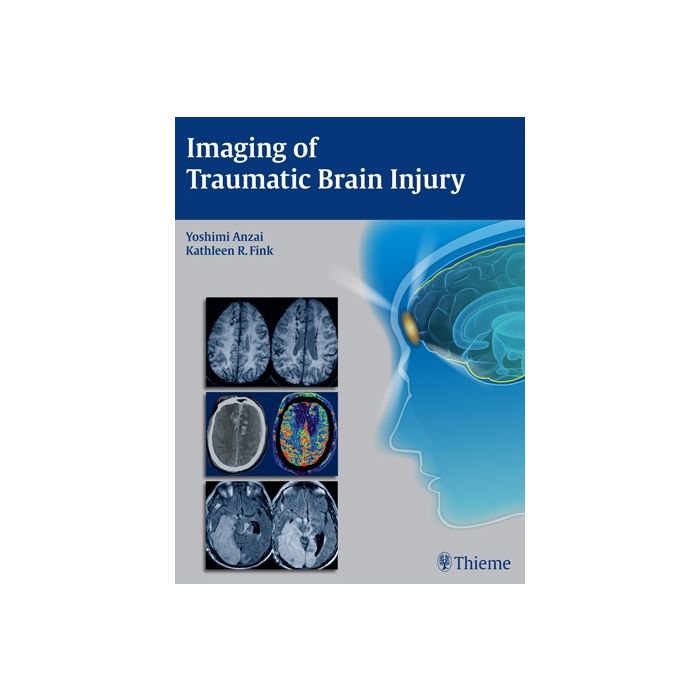 Imaging of Traumatic Brain Injury Anzai Yoshimi; Fink Kathleen R. Thieme Medical Publishers 9781604067286 Imaging of Traumatic Brain Injury Anzai Yoshimi; Fink Kathleen R. Thieme Medical Publishers 9781604067286