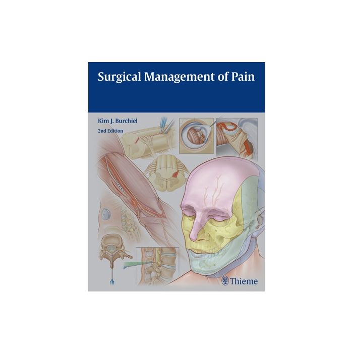 Surgical Management of Pain, 2/ed.  Burchiel Kim J.  Thieme Medical Publishers  9781604067514 Surgical Management of Pain, 2/ed.  Burchiel Kim J.  Thieme Medical Publishers  9781604067514