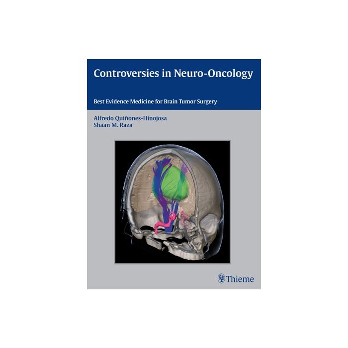 Controversies in Neuro-Oncology. Best Evidence Medicine for Brain Tumor Surgery  Quinones-Hinojosa Alfredo; Raza Shaan M.; Laws Edward R.  Thieme Medical Publishers  9781604067552