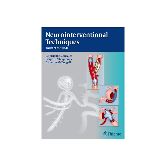 Neurointerventional Techniques. Tricks of the Trade Gonzalez Fernando L.; Albuquerque Felipe C.; Mcdougall Cameron G. Thieme Medical Publishers 9781604067576 Neurointerventional Techniques. Tricks of the Trade Gonzalez Fernando L.; Albuquerque Felipe C.; Mcdougall Cameron G. Thieme Medical Publishers 9781604067576