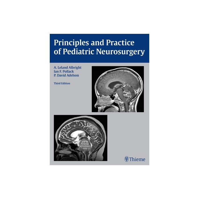 Principles and Practice of Pediatric Neurosurgery, 3/ed. Albright A.Leland; Pollack Ian F.; Adelson P. David Thieme Medical Publishers 9781604067996 Principles and Practice of Pediatric Neurosurgery, 3/ed. Albright A.Leland; Pollack Ian F.; Adelson P. David Thieme Medical Publishers 9781604067996