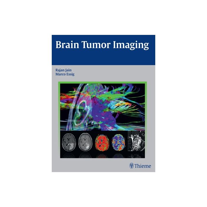 Brain Tumor Imaging Jain Rajan; Essig Marco Thieme 9781604068061 Brain Tumor Imaging Jain Rajan; Essig Marco Thieme 9781604068061