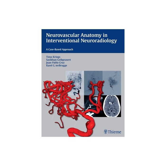 Neurovascular Anatomy in Interventional Neuroradiology. A Case-Based Approach  Krings Timo; Geibprasert Sasikhan; Cruz Juan Pablo; Ter Brugge Karel  Thieme Medical Publishers  9781604068399
