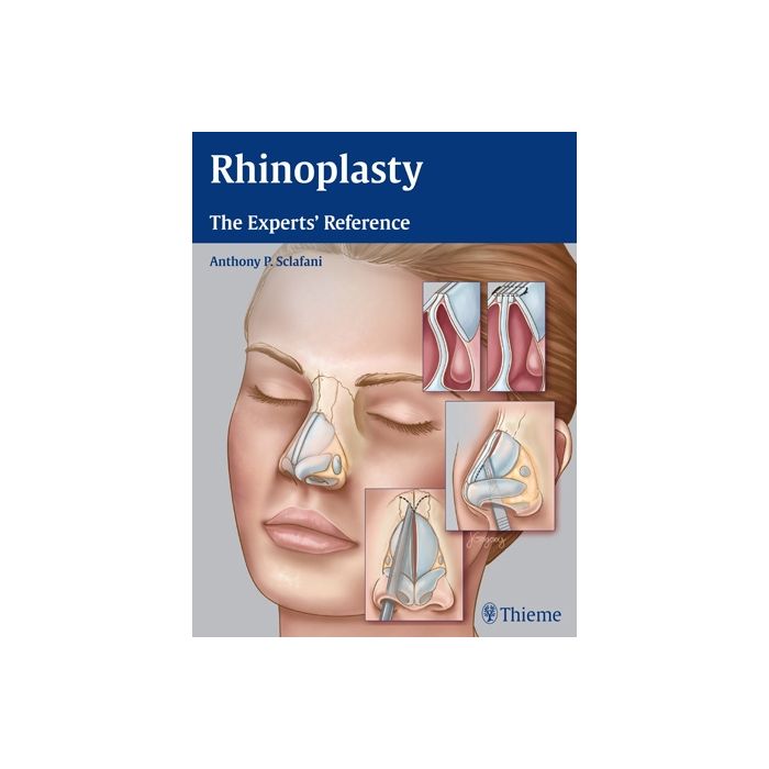 Rhinoplasty. The Experts' Reference Sclafani Anthony P. Thieme Medical Publishers 9781604068672 Rhinoplasty. The Experts' Reference Sclafani Anthony P. Thieme Medical Publishers 9781604068672