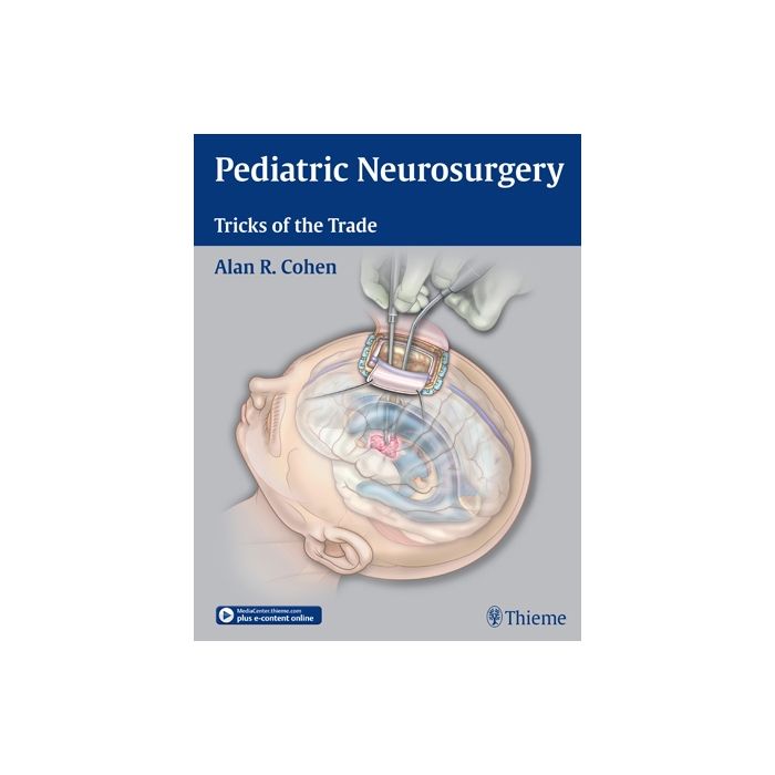 Pediatric Neurosurgery. Tricks of the Trade  Cohen Alan R  Thieme Medical Publishers  9781604068696