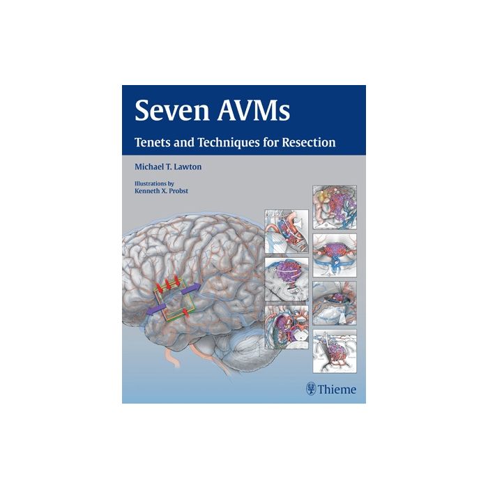 Seven AVMs. Tenets and Techniques for Resection  Lawton Michael T.  Thieme Medical Publishers  9781604068757 Seven AVMs. Tenets and Techniques for Resection  Lawton Michael T.  Thieme Medical Publishers  9781604068757