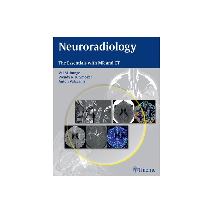 Neuroradiology. The Essentials with MR and CT  Runge Val M.; Smoker Wendy R. K.; Valavanis Antonios  Thieme Medical Publishers  9781604069167 Neuroradiology. The Essentials with MR and CT  Runge Val M.; Smoker Wendy R. K.; Valavanis Antonios  Thieme Medical Publishers  9781604069167