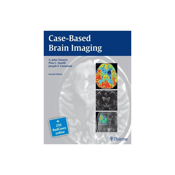 Case-Based Brain Imaging  Tsiouris A. John; Comunale Joseph P.; Sanelli Pina C.  Thieme Medical Publishers  9781604069532 Case-Based Brain Imaging  Tsiouris A. John; Comunale Joseph P.; Sanelli Pina C.  Thieme Medical Publishers  9781604069532