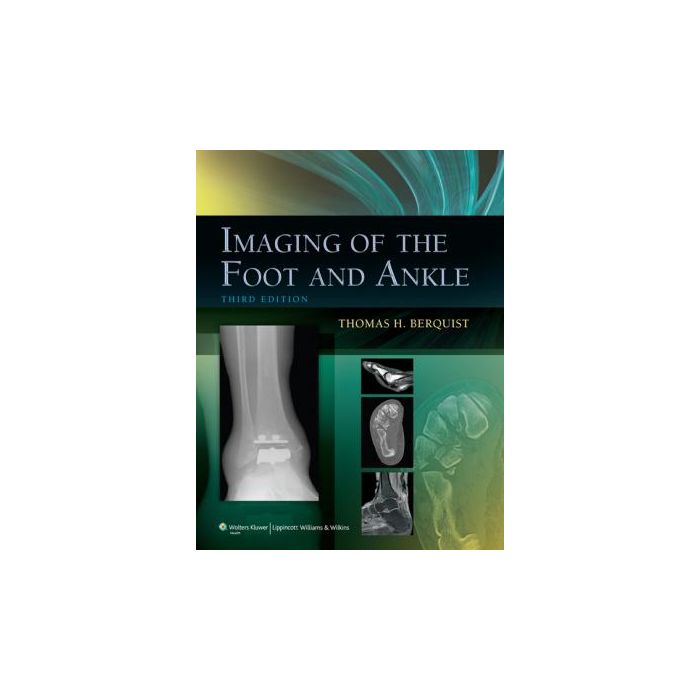 Imaging of the Foot and Ankle, 3ed. Berquist Thomas H. LIPPINCOTT Williams and Wilkins 9781605475721 Imaging of the Foot and Ankle, 3ed. Berquist Thomas H. LIPPINCOTT Williams and Wilkins 9781605475721