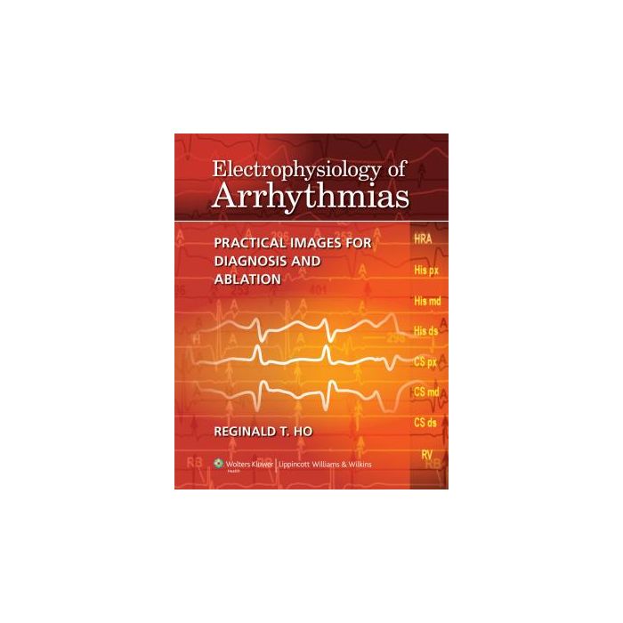 Electrophysiology of Arrhythmias  Ho Reginald T.  LIPPINCOTT Williams and Wilkins  9781605475905