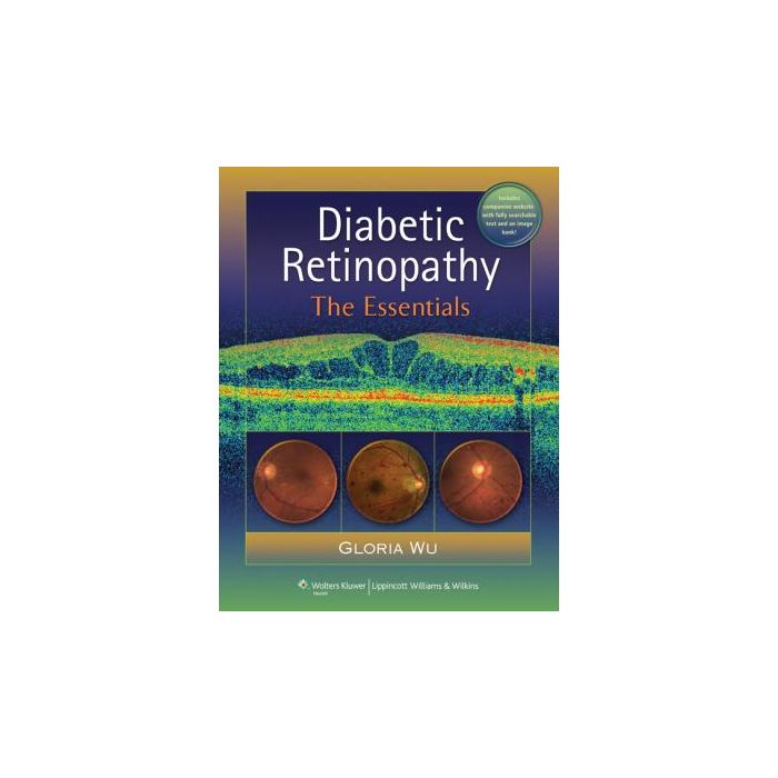 Diabetic Retinopathy  Wu Gloria  LIPPINCOTT Williams and Wilkins  9781605476629