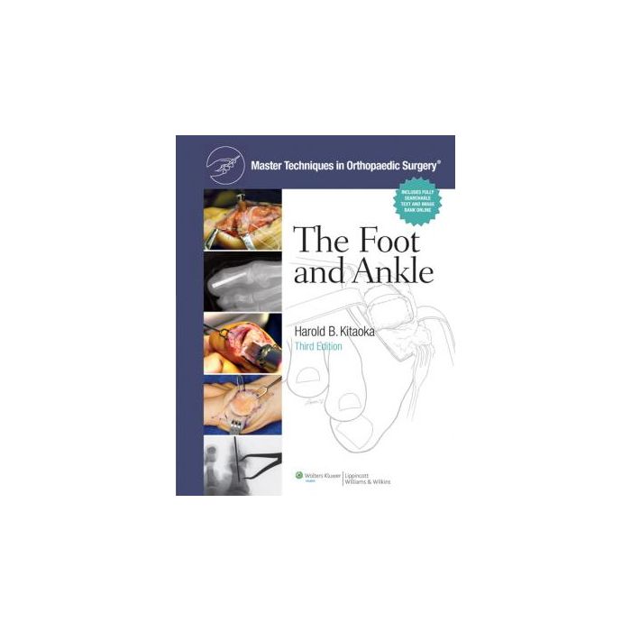 Master Techniques in Orthopaedic Surgery: The Foot and Ankle, 3ed.  Kitaoka Harold  LIPPINCOTT Williams and Wilkins  9781605476742