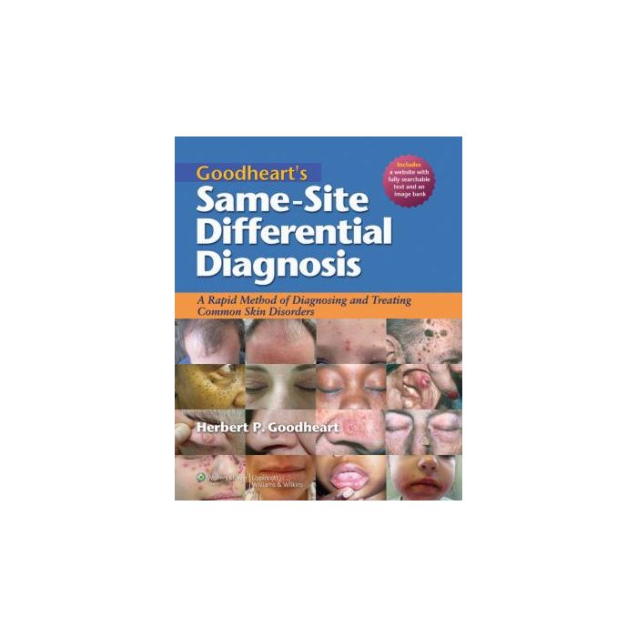 Goodheart's Same-Site Differential Diagnosis: A Rapid Method of Diagnosing and Treating Common Skin Disorders  Goodheart Herbert P.  LIPPINCOTT Williams and Wilkins  9781605477466