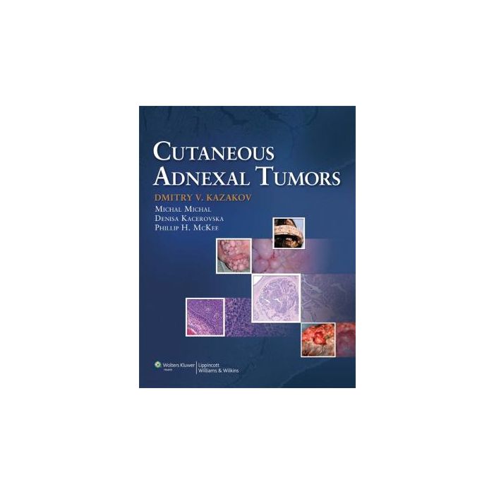 Cutaneous Adnexal Tumors Kazakov Dmitry V.; McKee Phillip; Michal Michal; Kacerovska Denise LIPPINCOTT Williams and Wilkins 9781605478548 Cutaneous Adnexal Tumors Kazakov Dmitry V.; McKee Phillip; Michal Michal; Kacerovska Denise LIPPINCOTT Williams and Wilkins 9781605478548