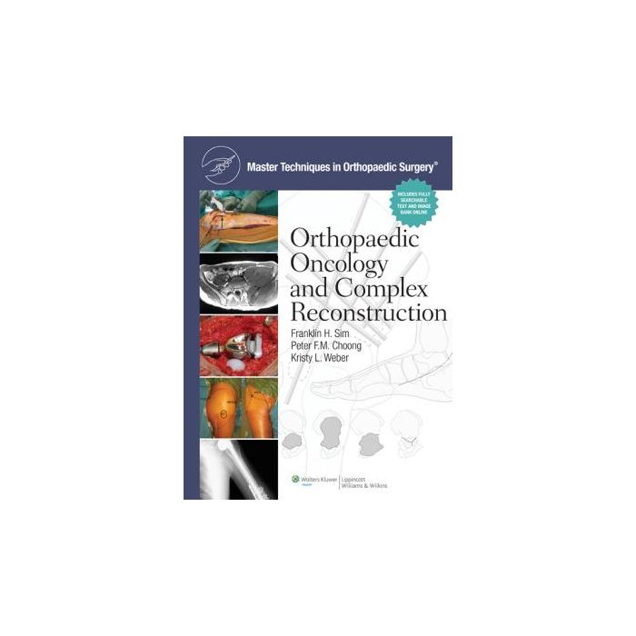 Master Techniques in Orthopaedic Surgery: Orthopaedic Oncology and Complex Reconstruction  Sim Franklin H.; Choong Peter F.M.; Weber Kristy L.  LIPPINCOTT Williams and Wilkins  9781608310432