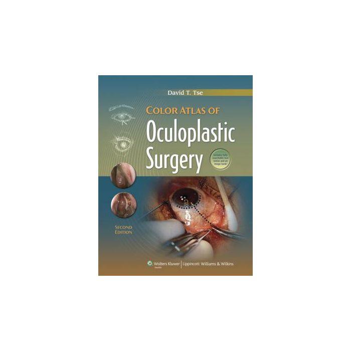 Color Atlas of Oculoplastic Surgery, 2ed. Tse David T. LIPPINCOTT Williams and Wilkins 9781608310784 Color Atlas of Oculoplastic Surgery, 2ed. Tse David T. LIPPINCOTT Williams and Wilkins 9781608310784