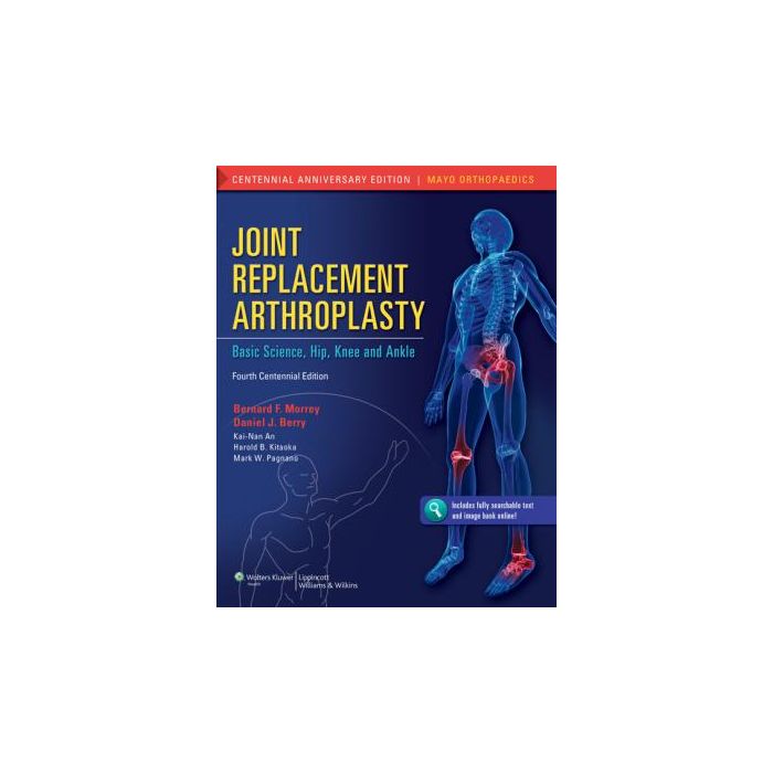 Joint Replacement Arthroplasty, 4ed. Morrey Bernard F.; Berry Daniel J.; An Kai-Nan; Kitaoka Harold B.; Pagnano Mark W. LIPPINCOTT Williams and Wilkins 9781608314706 Joint Replacement Arthroplasty, 4ed. Morrey Bernard F.; Berry Daniel J.; An Kai-Nan; Kitaoka Harold B.; Pagnano Mark W. LIPPINCOTT Williams and Wilkins 9781608314706