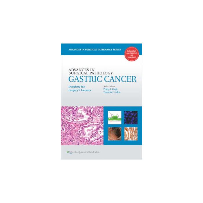 Advances in Surgical Pathology: Gastric Cancer Tan Dongfeng; Lauwers Gregory LIPPINCOTT Williams and Wilkins 9781608316175 Advances in Surgical Pathology: Gastric Cancer Tan Dongfeng; Lauwers Gregory LIPPINCOTT Williams and Wilkins 9781608316175