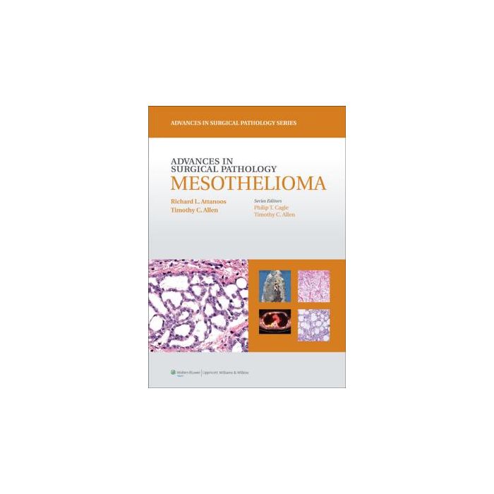 Advances in Surgical Pathology: Mesothelioma Attanoos Richard L.; Allen Timothy C. LIPPINCOTT Williams and Wilkins 9781608316182 Advances in Surgical Pathology: Mesothelioma Attanoos Richard L.; Allen Timothy C. LIPPINCOTT Williams and Wilkins 9781608316182