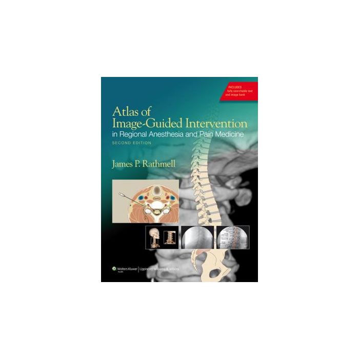 Atlas of Image-Guided Intervention in Regional Anesthesia and Pain Medicine, 2ed.  Rathmell James P.  LIPPINCOTT Williams and Wilkins  9781608317042