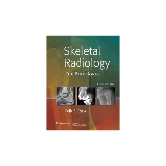 Skeletal Radiology: The Bare Bones, 3ed. Chew Felix S. LIPPINCOTT Williams and Wilkins 9781608317066 Skeletal Radiology: The Bare Bones, 3ed. Chew Felix S. LIPPINCOTT Williams and Wilkins 9781608317066
