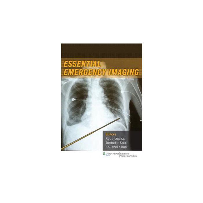 Essential Emergency Imaging Lewiss Resa E.; Saul Turandot; Shah Kaushal H. LIPPINCOTT Williams and Wilkins 9781608318933 Essential Emergency Imaging Lewiss Resa E.; Saul Turandot; Shah Kaushal H. LIPPINCOTT Williams and Wilkins 9781608318933