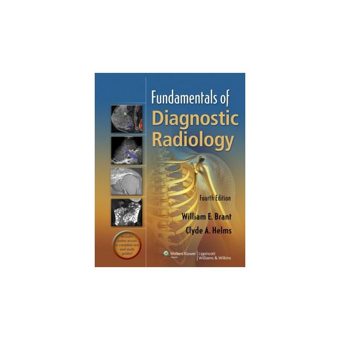 Fundamentals of Diagnostic Radiology, 4ed. Brant William E.; Helms Clyde LIPPINCOTT Williams and Wilkins 9781608319114 Fundamentals of Diagnostic Radiology, 4ed. Brant William E.; Helms Clyde LIPPINCOTT Williams and Wilkins 9781608319114