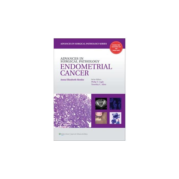 Advances in Surgical Pathology: Endometrial Carcinoma Sienko Anna LIPPINCOTT Williams and Wilkins 9781609131784 Advances in Surgical Pathology: Endometrial Carcinoma Sienko Anna LIPPINCOTT Williams and Wilkins 9781609131784