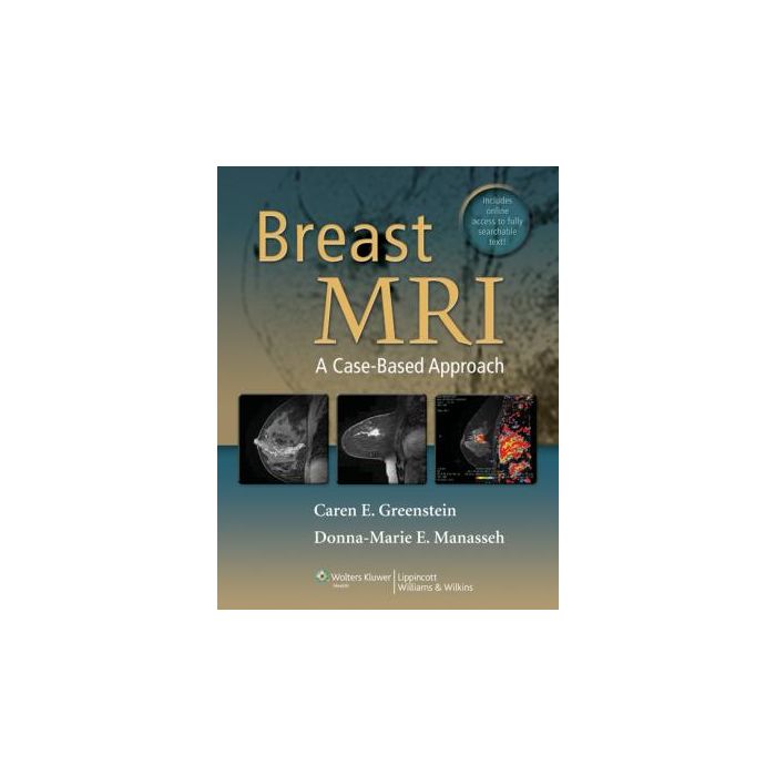 Breast MRI. A Case-based approach  Greenstein Caren; Manasseh Donna Marie E.  LIPPINCOTT Williams and Wilkins  9781609132361