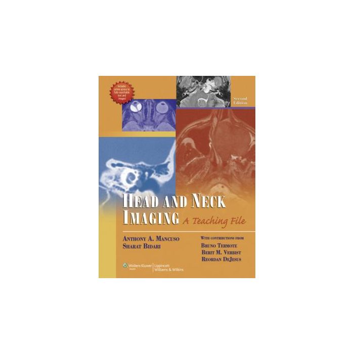 Head and Neck Imaging, 2ed.  Mancuso Anthony A.; Bidari Sharat; Termote Bruno; Verbist Berit M.; DeJesus Reordan  LIPPINCOTT Williams and Wilkins  9781609137120