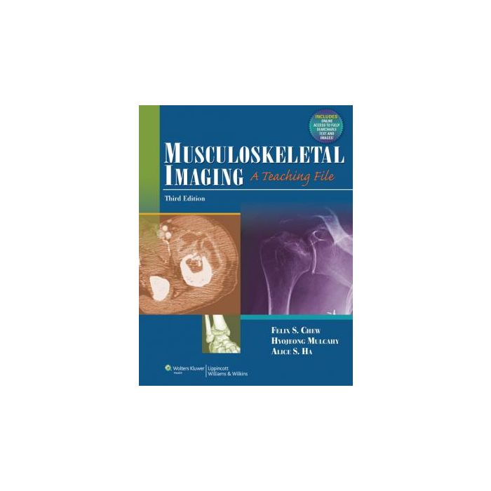 Musculoskeletal Imaging, 3ed. Chew Felix LIPPINCOTT Williams and Wilkins 9781609137939 Musculoskeletal Imaging, 3ed. Chew Felix LIPPINCOTT Williams and Wilkins 9781609137939