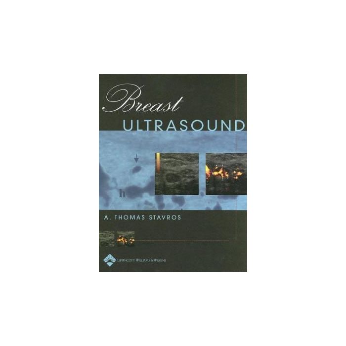 Breast Ultrasound, 2ed. Stavros A. Thomas; Rapp Cynthia L.; Parker Steve H. LIPPINCOTT Williams and Wilkins 9781609138110 Breast Ultrasound, 2ed. Stavros A. Thomas; Rapp Cynthia L.; Parker Steve H. LIPPINCOTT Williams and Wilkins 9781609138110