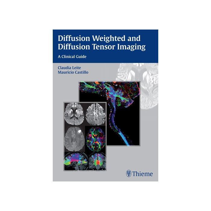 Diffusion Weighted and Diffusion Tensor Imaging. A Clinical Guide  Leite Claudia; Castillo Mauricio  Thieme  9781626230217 Diffusion Weighted and Diffusion Tensor Imaging. A Clinical Guide  Leite Claudia; Castillo Mauricio  Thieme  9781626230217
