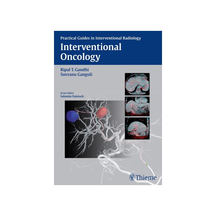 Interventional Oncology  Gandhi Ripal T.; Ganguli Suvranu  Thieme  9781626230811