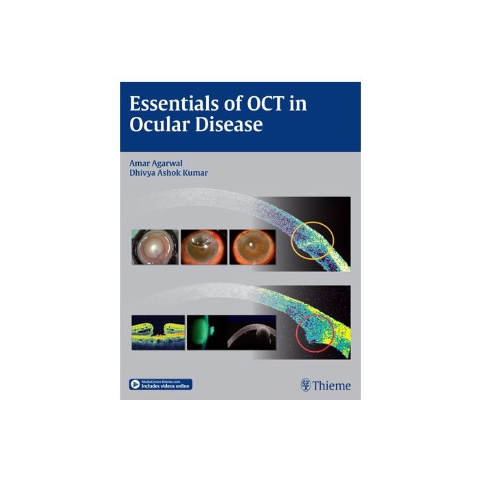 Essentials of OCT in Ocular Disease  Agarwal Amar; Steinert Roger F.; Kumar Dhivya Ashok  Thieme Medical Publishers  9781626230989
