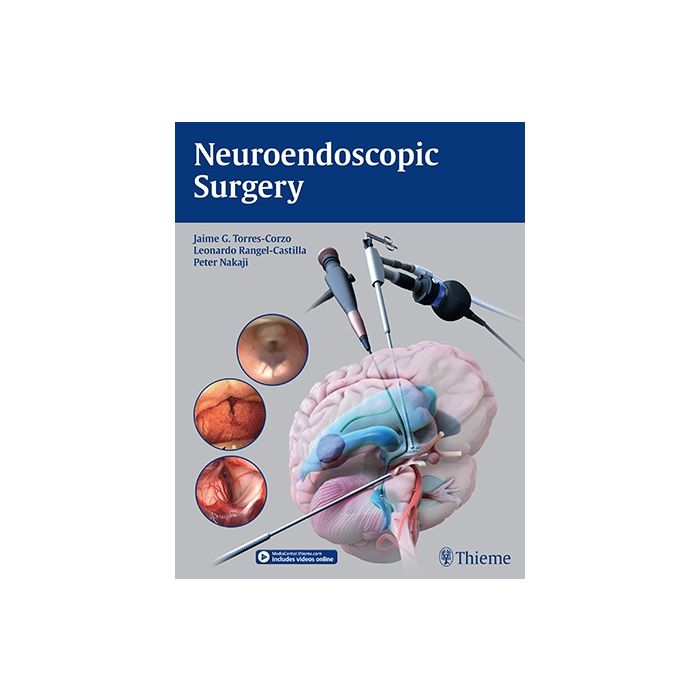 Neuroendoscopic Surgery  Torres-Corzo Jaime; Rangel-Castilla Leonardo; Nakaji Peter  Thieme Medical Publishers  9781626231610